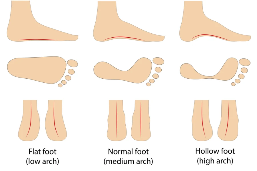 You should determine your foot arch type to pick the right shoe insoles